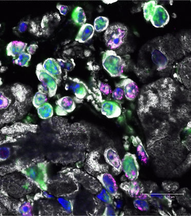Cardiac derived stem-like cells | Khanlab